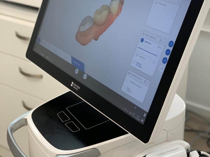 Nieuw: Cerec 3D