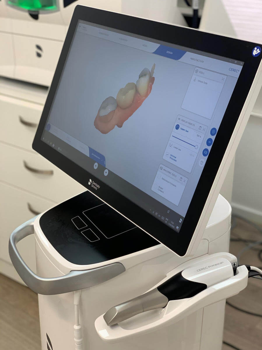 Cerec 3D Smilez Primescan